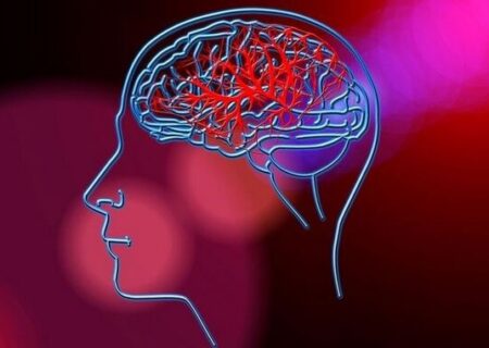 وقوع سالانه ۸۰۰۰ سکته مغزی در خوزستان/ نیاز به ۶۰ تخت ویژه استروک در اهواز