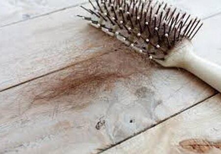 دلایل ریزش موی جلوی سر در زنان