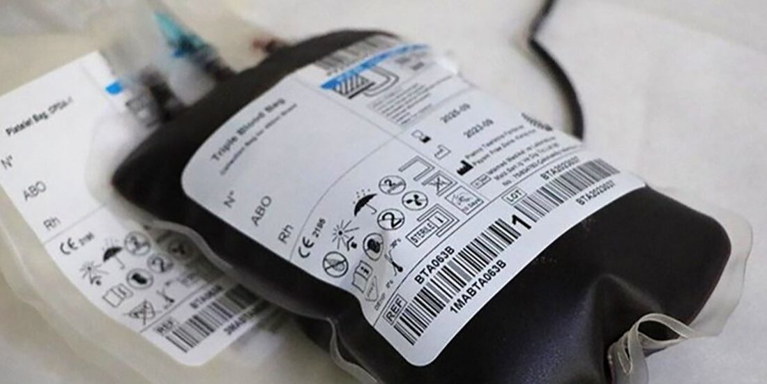 تایید آلوده شدن 113 بیمار تالاسمی به هپاتیت سی در سیستان و بلوچستان / علت در دست بررسی