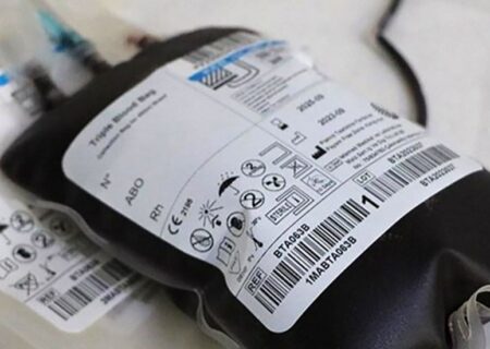 تایید آلوده شدن 113 بیمار تالاسمی به هپاتیت سی در سیستان و بلوچستان / علت در دست بررسی