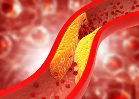 چند نشانه که خبر از گرفتگی رگ‌ های قلب می دهند