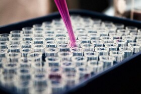 درمان پارکینسون به کمک «نورون‌های پنهان»