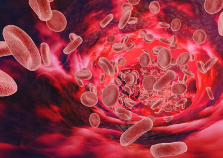 آیا بیماری هموفیلی قابل درمان است؟ 