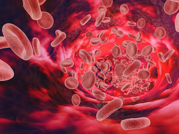 آیا بیماری هموفیلی قابل درمان است؟