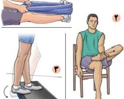 درمان عارضه «کف پای گود» با چند حرکت اصلاحی