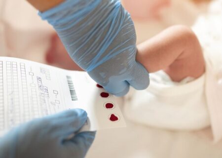 غربالگری کم‌کاری تیروئید برای بیش از یک‌میلیون و ۴۰۰ نوزاد خوزستانی