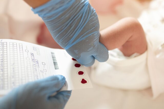 غربالگری کمکاری تیروئید برای بیش از یکمیلیون و ۴۰۰ نوزاد خوزستانی