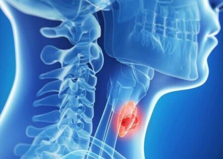 بهترین مواد غذایی برای نجات تیروئید