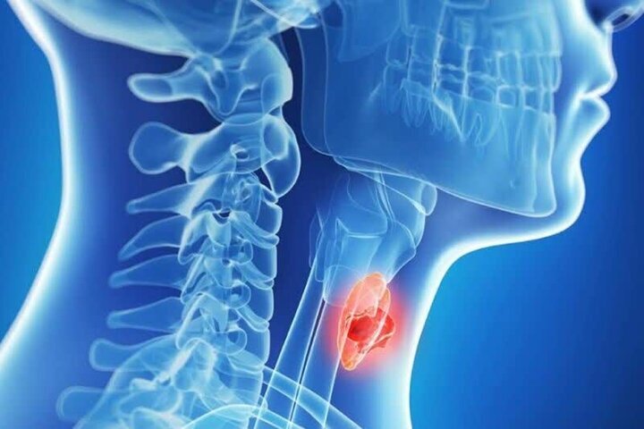 بهترین مواد غذایی برای نجات تیروئید