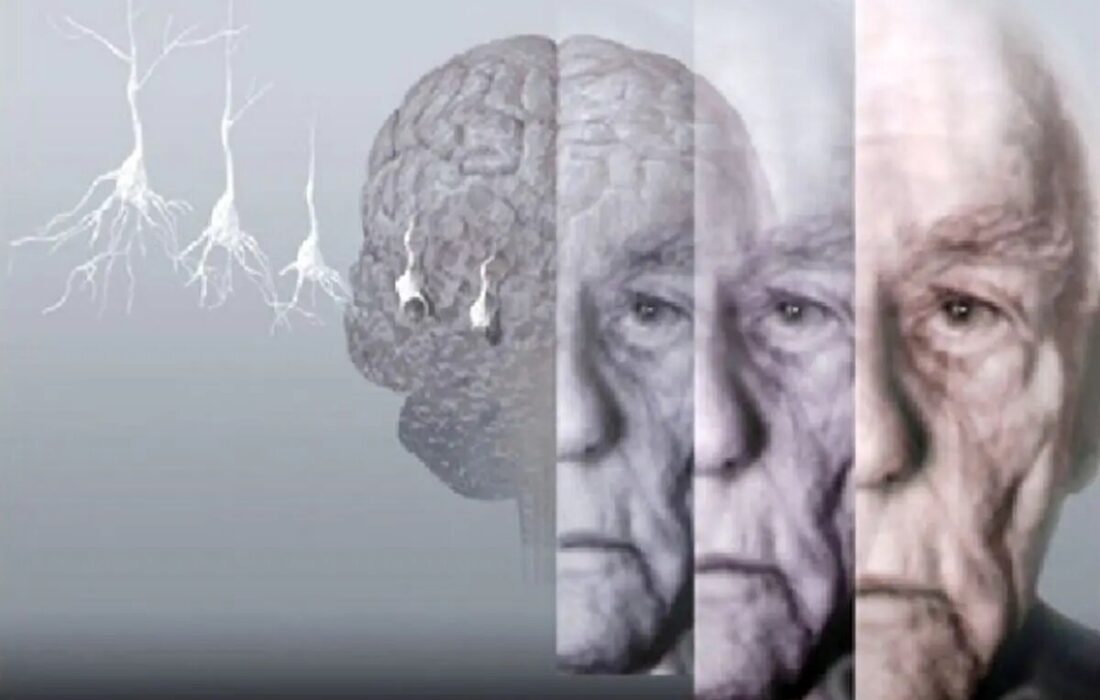 ۵ روش برای حفظ عملکرد مغز