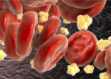 کاهش ۴۹ درصدی «کلسترول بد» خون با ترکیب دو دارو