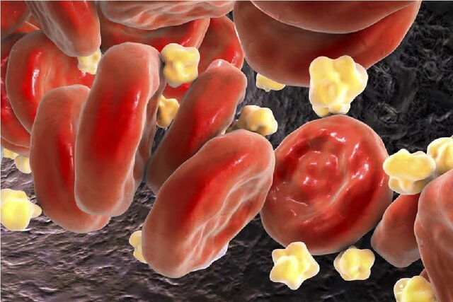 کاهش ۴۹ درصدی «کلسترول بد» خون با ترکیب دو دارو