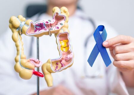 همه چیز درباره سرطان روده بزرگ/ علائم، مراحل گسترش خطر، علل و انواع درمان