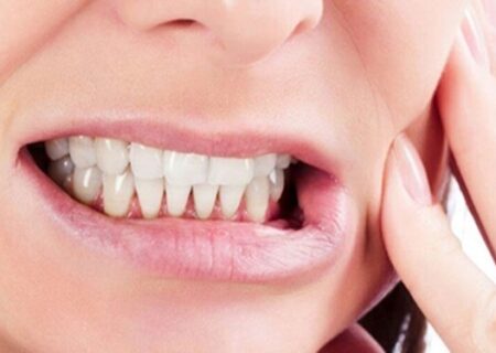 ابتلا به این بیماری‌ها به‌دلیل پوسیدگی دندان‌