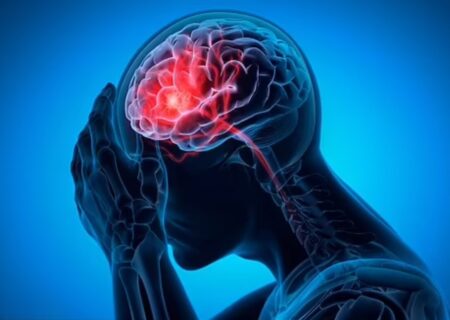 نشانه‌های مهم سکته مغزی را بشناسید