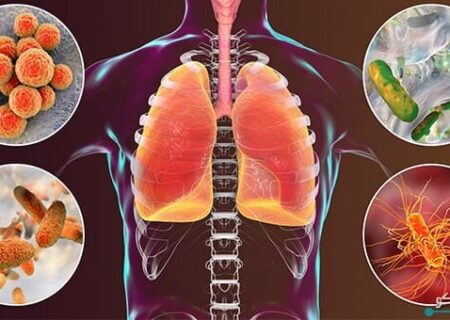 اعلام نتایج یک مطالعه جدید و مهم درباره کپک خانگی