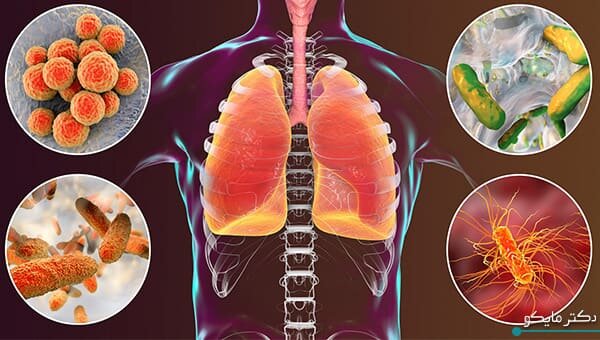 اعلام نتایج یک مطالعه جدید و مهم درباره کپک خانگی