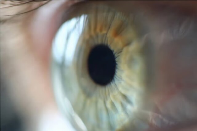 سرماخوردگی چشمی؛ بیماری شایعی که به سرعت اعضای خانواده را درگیر میکند