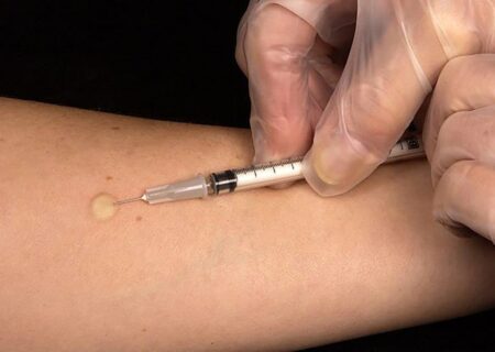 مشکل انسولین در کشور نداریم