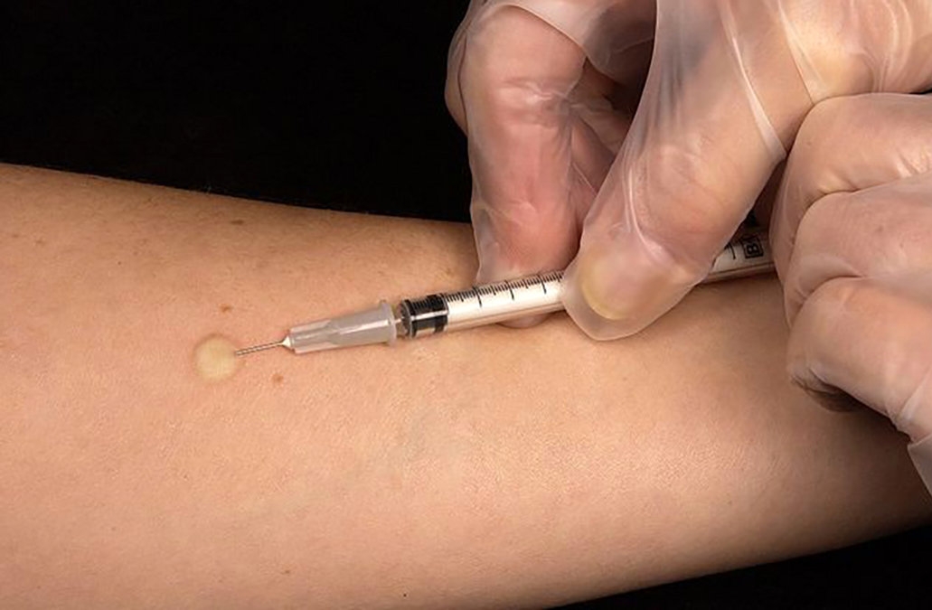 مشکل انسولین در کشور نداریم