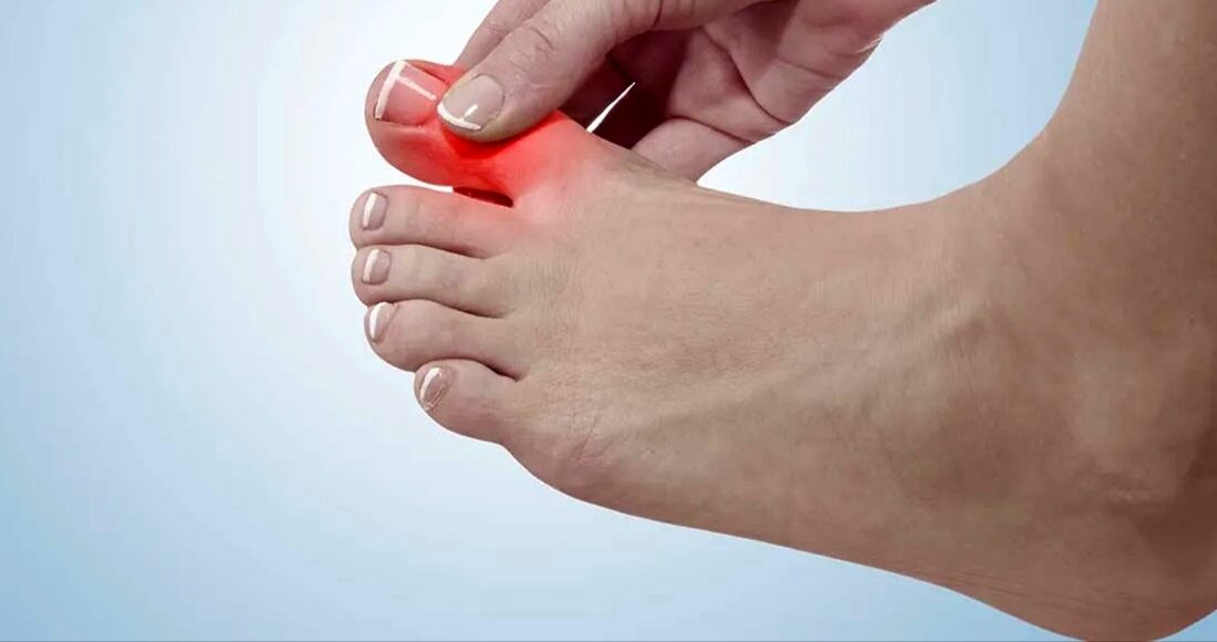 درد شست پا می تواند نشانه بیماری های جدی باشد !