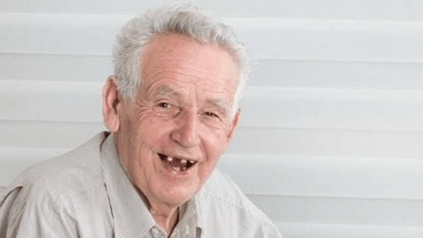 نیمی از افراد بالای ۶۵ سال هیچ دندانی ندارند