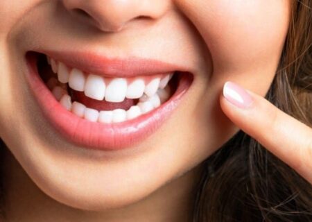 خوراکی‌های مفید برای سلامت دندان