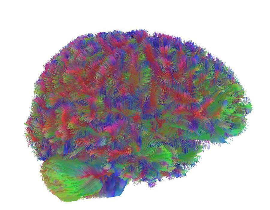 پنج دوره ساختاری مغز؛ کشف نقاط عطف سیم کشی عصبی از تولد تا کهنسالی