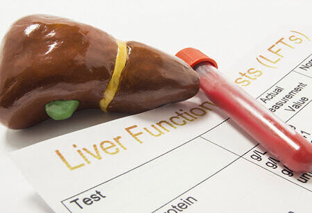 علت بالا رفتن آنزیم‌های کبدی چیست؟/ باید مراقب چه علائمی باشیم